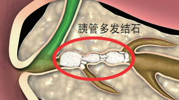 肠道微生态：消化道的隐秘宇宙