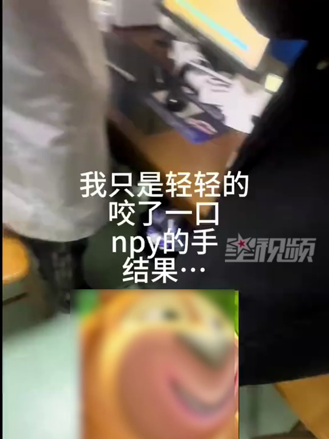 情侣玩闹酿意外，男生被女友咬手疼进医院引关注